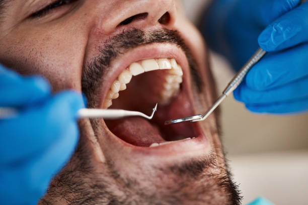 Best Emergency Treatment for Toothache in Somers, MT